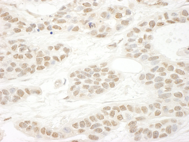 FUSIP1 Antibody in Immunohistochemistry (IHC)