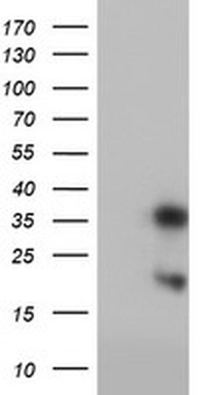 FXN Antibody in Western Blot (WB)