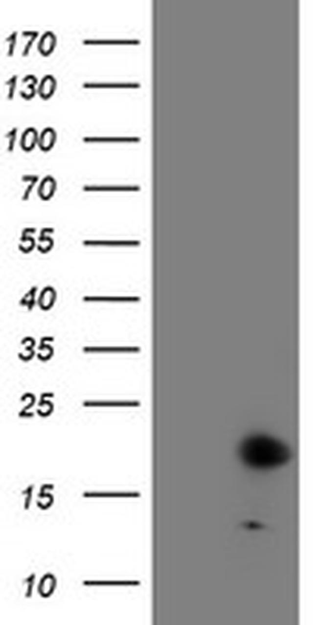 FXN Antibody in Western Blot (WB)