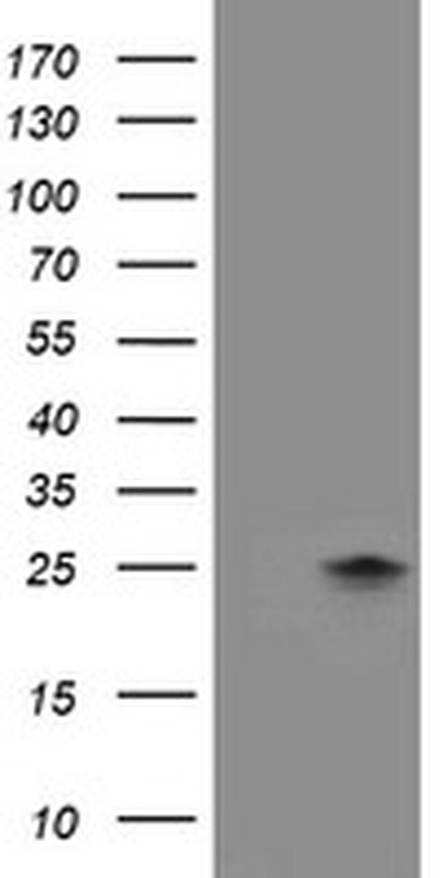 FXN Antibody in Western Blot (WB)