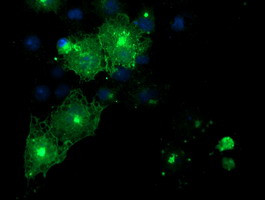 FXYD3 Antibody in Immunocytochemistry (ICC/IF)