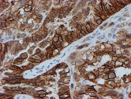 FXYD3 Antibody in Immunohistochemistry (Paraffin) (IHC (P))