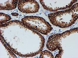 FXYD3 Antibody in Immunohistochemistry (Paraffin) (IHC (P))