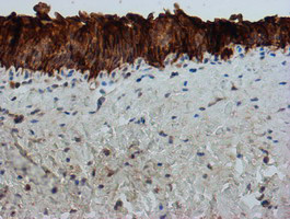 FXYD3 Antibody in Immunohistochemistry (Paraffin) (IHC (P))