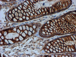 FXYD3 Antibody in Immunohistochemistry (Paraffin) (IHC (P))