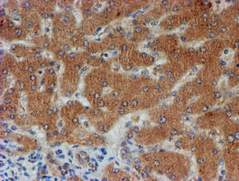 FXYD3 Antibody in Immunohistochemistry (Paraffin) (IHC (P))