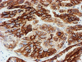 FXYD3 Antibody in Immunohistochemistry (Paraffin) (IHC (P))