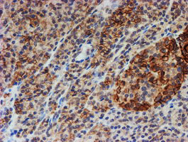 FXYD3 Antibody in Immunohistochemistry (Paraffin) (IHC (P))