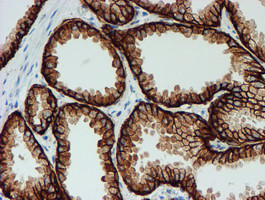 FXYD3 Antibody in Immunohistochemistry (Paraffin) (IHC (P))