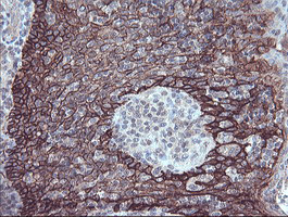 FXYD3 Antibody in Immunohistochemistry (Paraffin) (IHC (P))