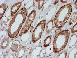 FXYD3 Antibody in Immunohistochemistry (Paraffin) (IHC (P))