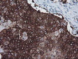 FXYD3 Antibody in Immunohistochemistry (Paraffin) (IHC (P))