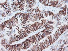 FXYD3 Antibody in Immunohistochemistry (Paraffin) (IHC (P))