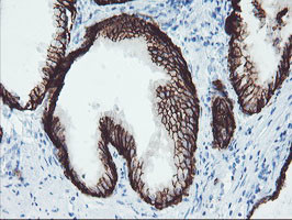 FXYD3 Antibody in Immunohistochemistry (Paraffin) (IHC (P))