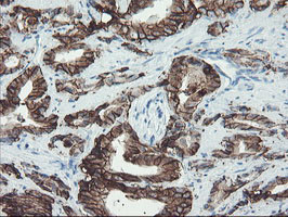 FXYD3 Antibody in Immunohistochemistry (Paraffin) (IHC (P))