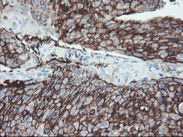 FXYD3 Antibody in Immunohistochemistry (Paraffin) (IHC (P))