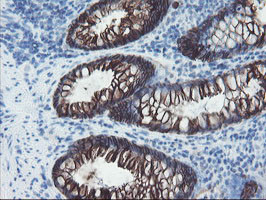 FXYD3 Antibody in Immunohistochemistry (Paraffin) (IHC (P))