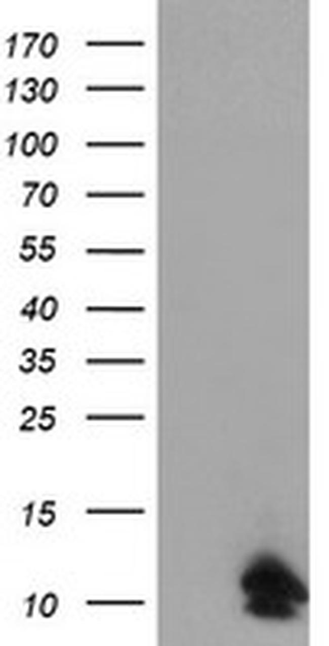 FXYD3 Antibody in Western Blot (WB)