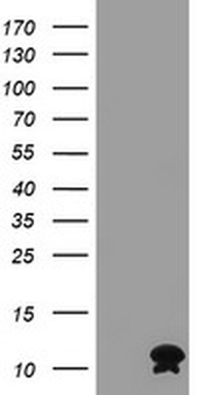 FXYD3 Antibody in Western Blot (WB)