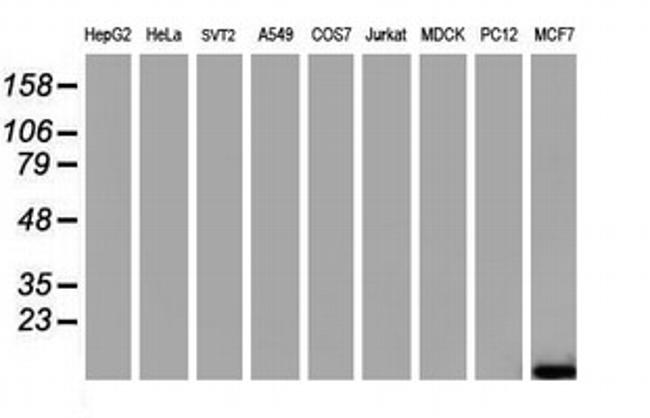 FXYD3 Antibody in Western Blot (WB)