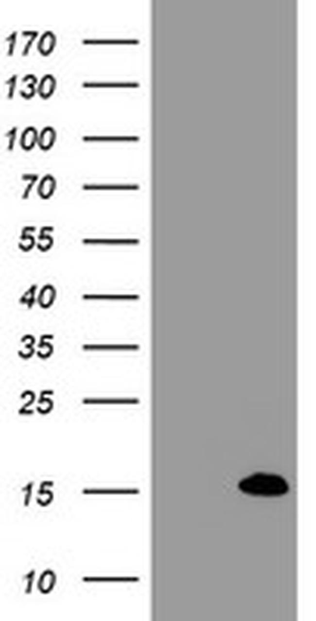 FXYD3 Antibody in Western Blot (WB)