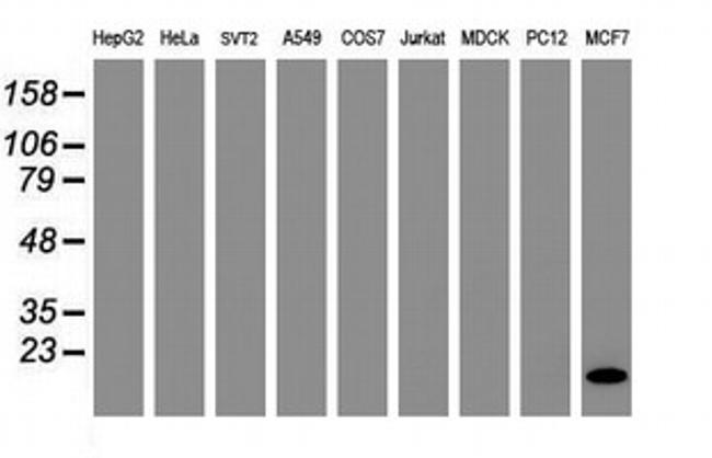 FXYD3 Antibody in Western Blot (WB)