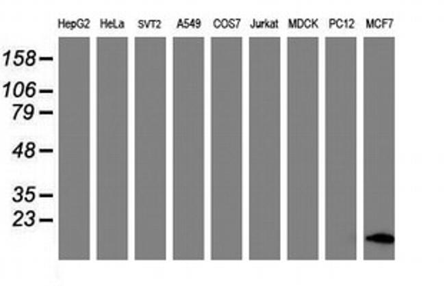 FXYD3 Antibody in Western Blot (WB)