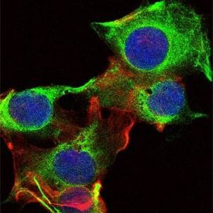 Fyn Antibody in Immunocytochemistry (ICC/IF)