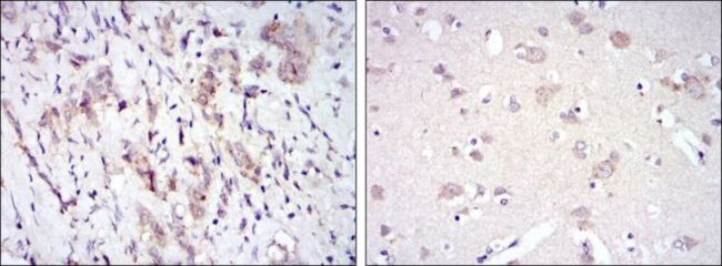 Fyn Antibody in Immunohistochemistry (Paraffin) (IHC (P))