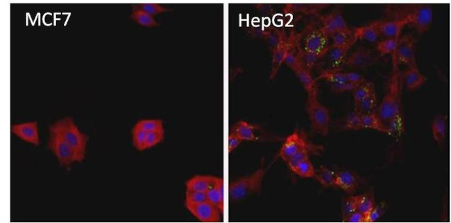 Ferritin Antibody in Immunocytochemistry (ICC/IF)