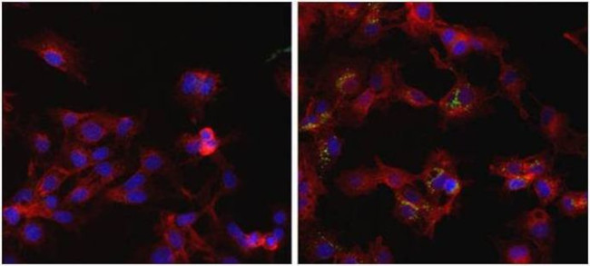 Ferritin Antibody in Immunocytochemistry (ICC/IF)