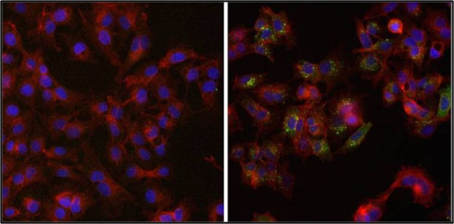 Ferritin Antibody in Immunocytochemistry (ICC/IF)