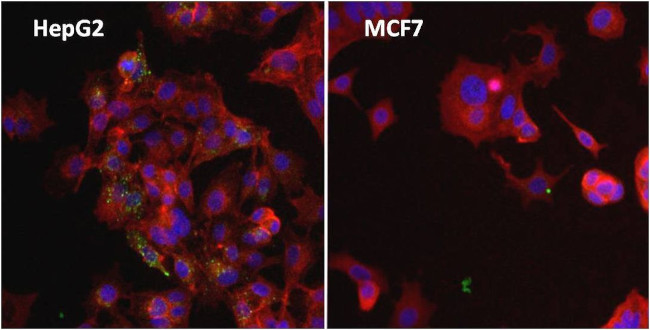 Ferritin Antibody in Immunocytochemistry (ICC/IF)