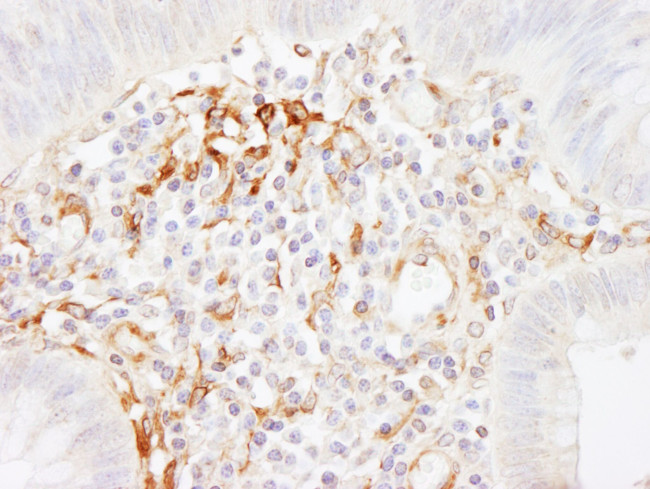 Filamin A Antibody in Immunohistochemistry (IHC)