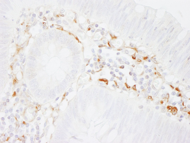 Filamin A Antibody in Immunohistochemistry (IHC)