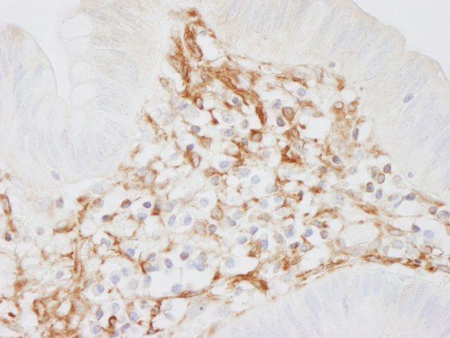 Filamin A Antibody in Immunohistochemistry (IHC)