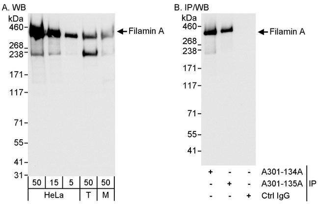Filamin A Antibody in Western Blot (WB)