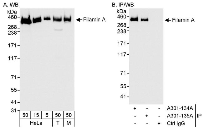 Filamin A Antibody in Western Blot (WB)