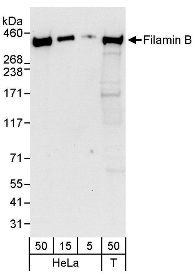 Filamin B Antibody in Western Blot (WB)