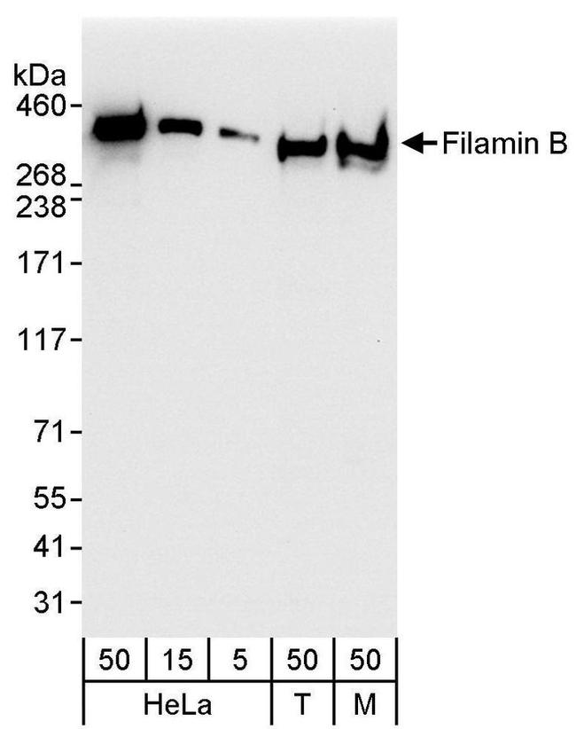 Filamin B Antibody in Western Blot (WB)