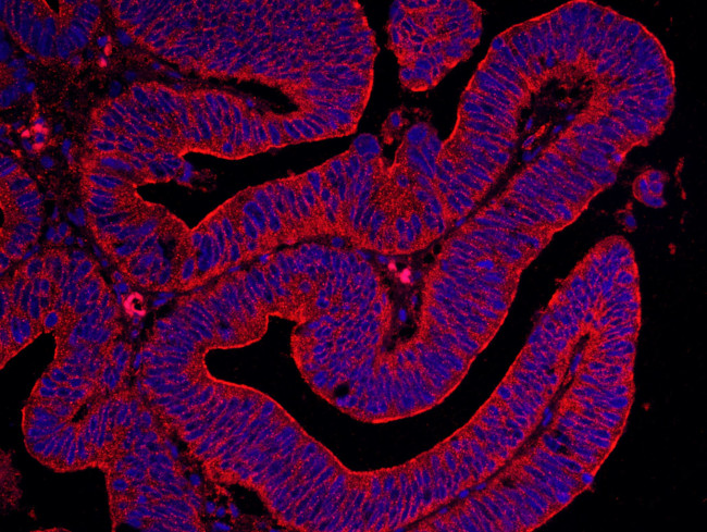 Filamin B Antibody in Immunohistochemistry (IHC)