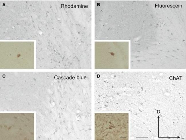 TRITC Antibody in Immunohistochemistry (IHC)