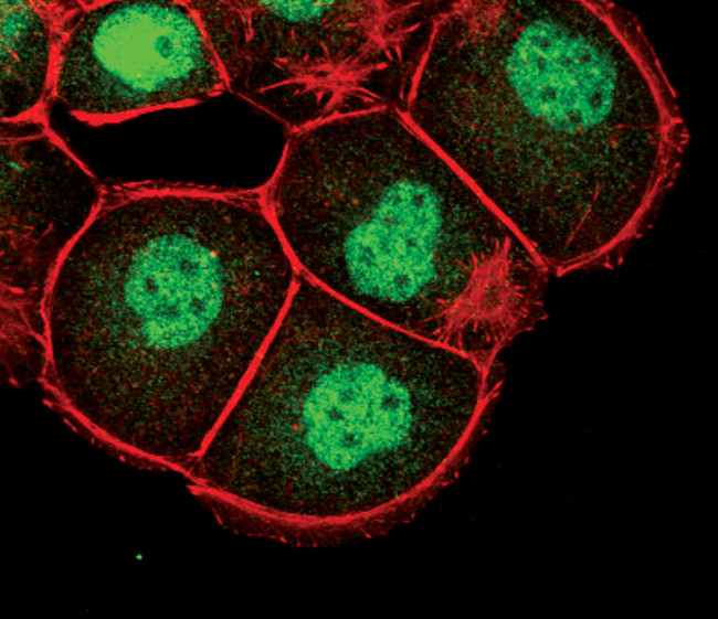 FOXO1 Antibody in Immunocytochemistry (ICC/IF)