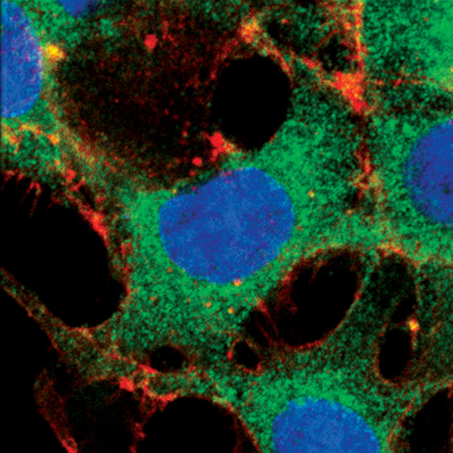 FOXO3A Antibody in Immunocytochemistry (ICC/IF)