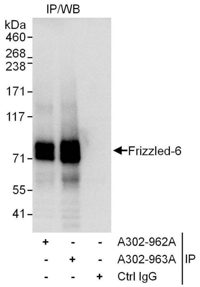 Frizzled-6 Antibody in Immunoprecipitation (IP)