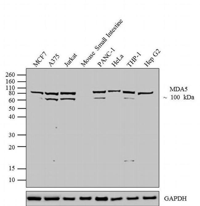 Rabbit IgG (H+L) Cross-Adsorbed Secondary Antibody in Western Blot (WB)