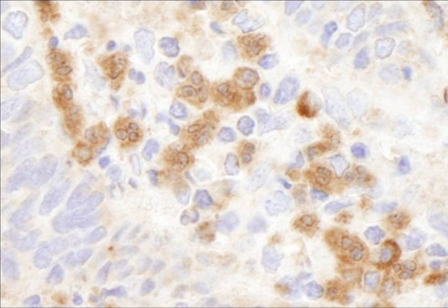 G6PD Antibody in Immunohistochemistry (IHC)