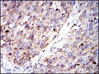 G6PD Antibody in Immunohistochemistry (Paraffin) (IHC (P))