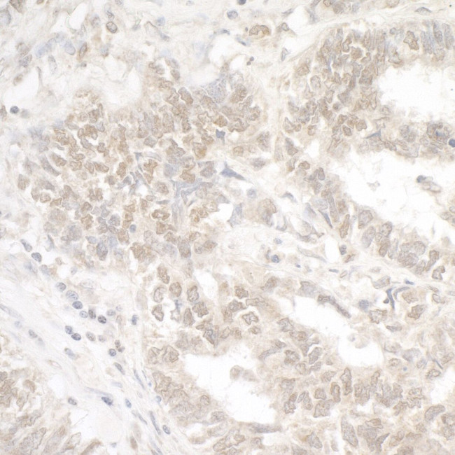 G9A/EHMT2 Antibody in Immunohistochemistry (IHC)