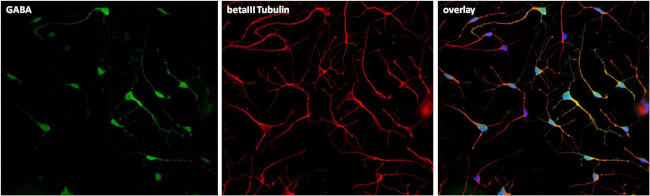 GABA Antibody in Immunocytochemistry (ICC/IF)